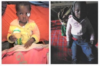 Great Britain – Kind benefactors fund cancer treatment for 2 children in Kenya